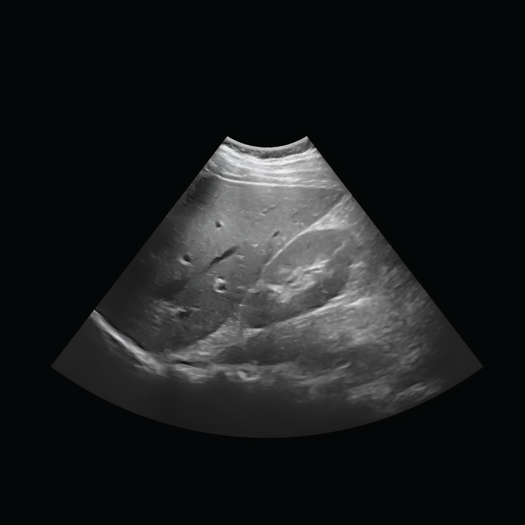 Short Ultrasound Scan Image